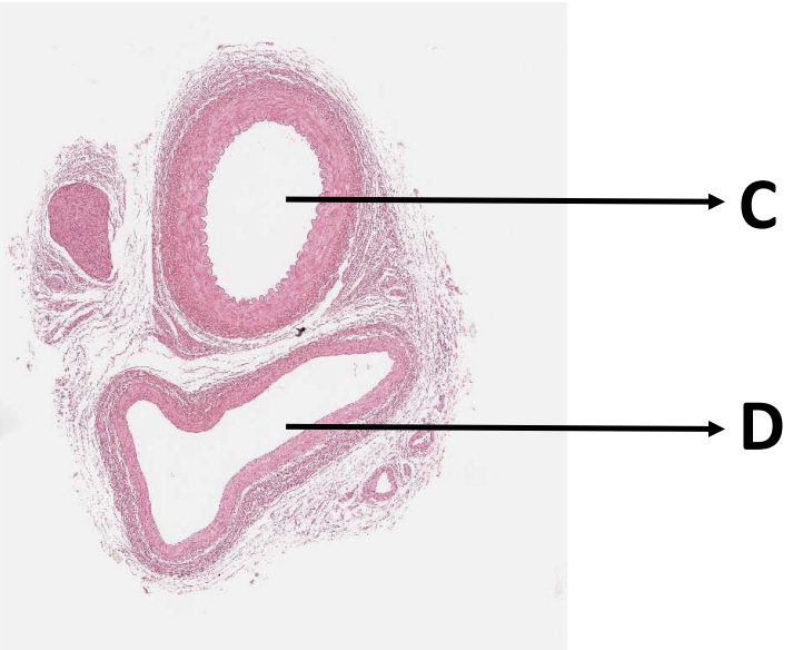 <p>identify vessel C and D</p>