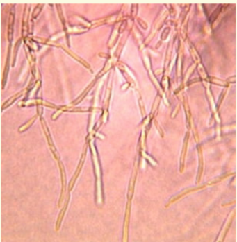 <p><span style="color: #f4f4f4">Isolated in urinary tract infections,</span><span style="color: #f4f4f4"><br></span><span style="color: #f4f4f4">4pyelonephritis</span><span style="color: #f4f4f4"><br></span><span style="color: #f4f4f4">4endocarditis</span><span style="color: #f4f4f4"><br></span><span style="color: #f4f4f4">4cutaneous</span><span style="color: #f4f4f4"><br></span><span style="color: #f4f4f4">4paronychia</span><span style="color: #f4f4f4"><br></span><span style="color: #f4f4f4">4otitis externa</span><span style="color: #f4f4f4"><br></span><span style="color: #f4f4f4">4mycotic keratitis</span><span style="color: #f4f4f4"><br></span><span style="color: #f4f4f4">4fungemia, and vaginitis.</span></p><p><span style="color: #f7f4f4">Yeast like colonies at</span><span style="color: #f7f4f4"><br></span><span style="color: #f7f4f4">both 25 and 37o C.</span><span style="color: #f7f4f4"><br></span><span style="color: #f7f4f4">4 Blastoconidia and</span><span style="color: #f7f4f4"><br></span><span style="color: #f7f4f4">pseudohyphae</span><span style="color: #f7f4f4"><br></span><span style="color: #f7f4f4">4 Short, curved</span><span style="color: #f7f4f4"><br></span><span style="color: #f7f4f4">pseudohyphae cells</span><span style="color: #f7f4f4"><br></span><span style="color: #f7f4f4">– develop into giant cells</span><span style="color: #f7f4f4"><br></span><span style="color: #f7f4f4">4 Germ tube negative</span><span style="color: #f7f4f4"><br></span><span style="color: #f7f4f4">4 Chlamydospore</span><span style="color: #f7f4f4"><br></span><span style="color: #f7f4f4">negative</span><span style="color: #f7f4f4"><br></span><span style="color: #f7f4f4">4 Capsule neg</span><span style="color: #f7f4f4"><br></span><span style="color: #f7f4f4">4 Sensitive to</span><span style="color: #f7f4f4"><br></span><span style="color: #f7f4f4">cycloheximide</span><span style="color: #f4f4f4"><br></span></p>