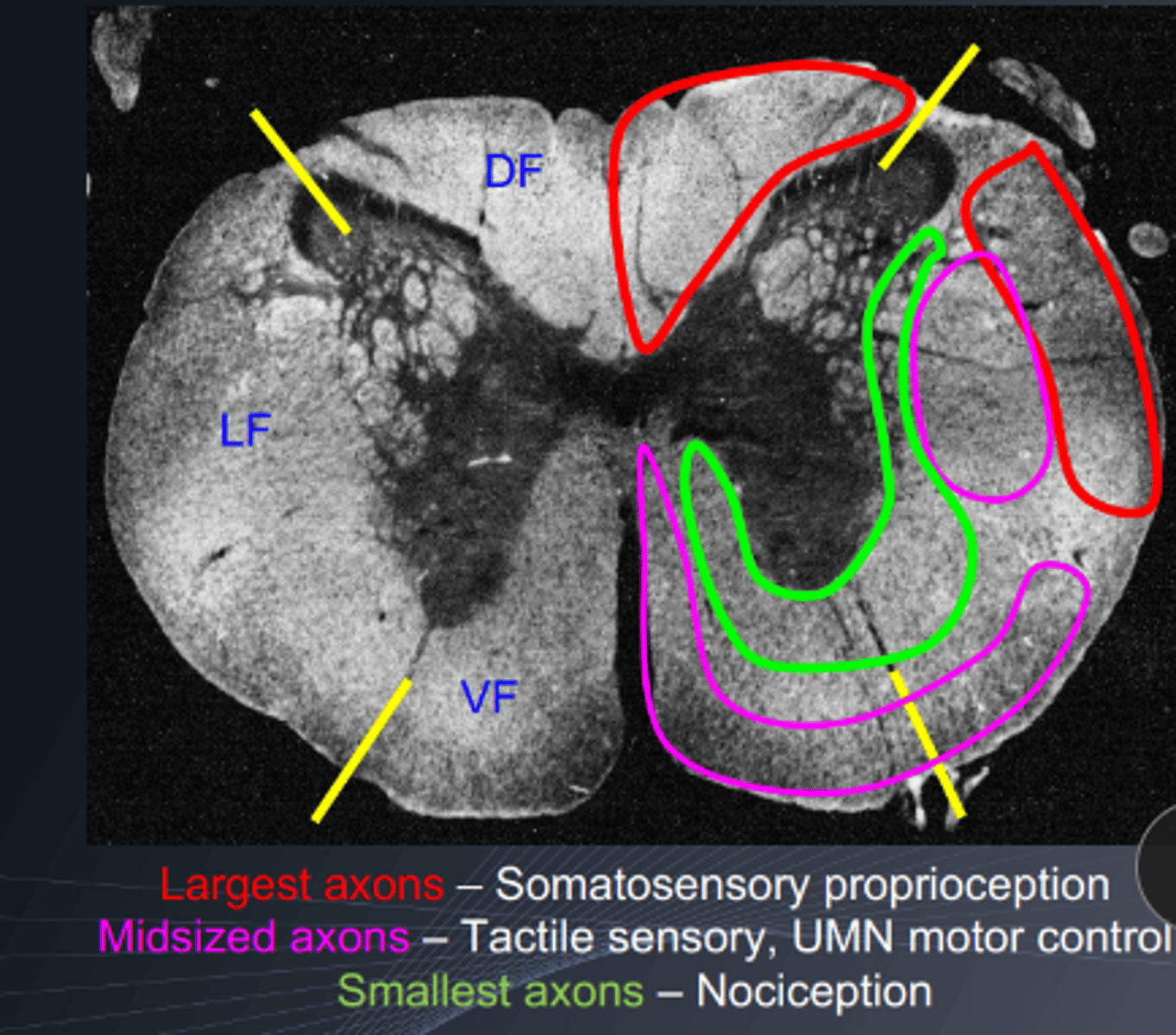 <p>proprioception</p><p>motor function</p><p>conscious pain sensation</p><p>proprioceptive fibers are the largest axons with heavy myelination</p>