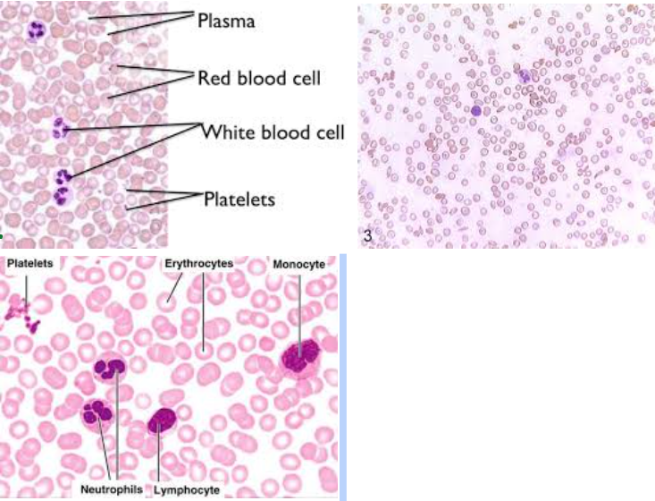 <p><strong>Blood connective tissue</strong></p>