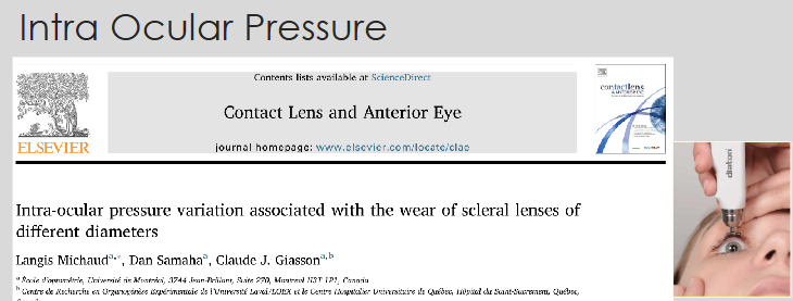 <ul><li><p>As measured using a non-standard <strong>transpalpebral IOP method</strong>, scleral lens wear may <strong>increase IOP by ~5 mmHg on average</strong>.</p><ul><li><p>Regardless&nbsp;<strong>of scleral lens diameter</strong>.</p></li></ul></li><li><p>Further research =req’d to det whether clinicians should exercise caution when fitting scleral lenses on <strong>patients at risk for glaucoma</strong>.</p></li></ul><p></p>