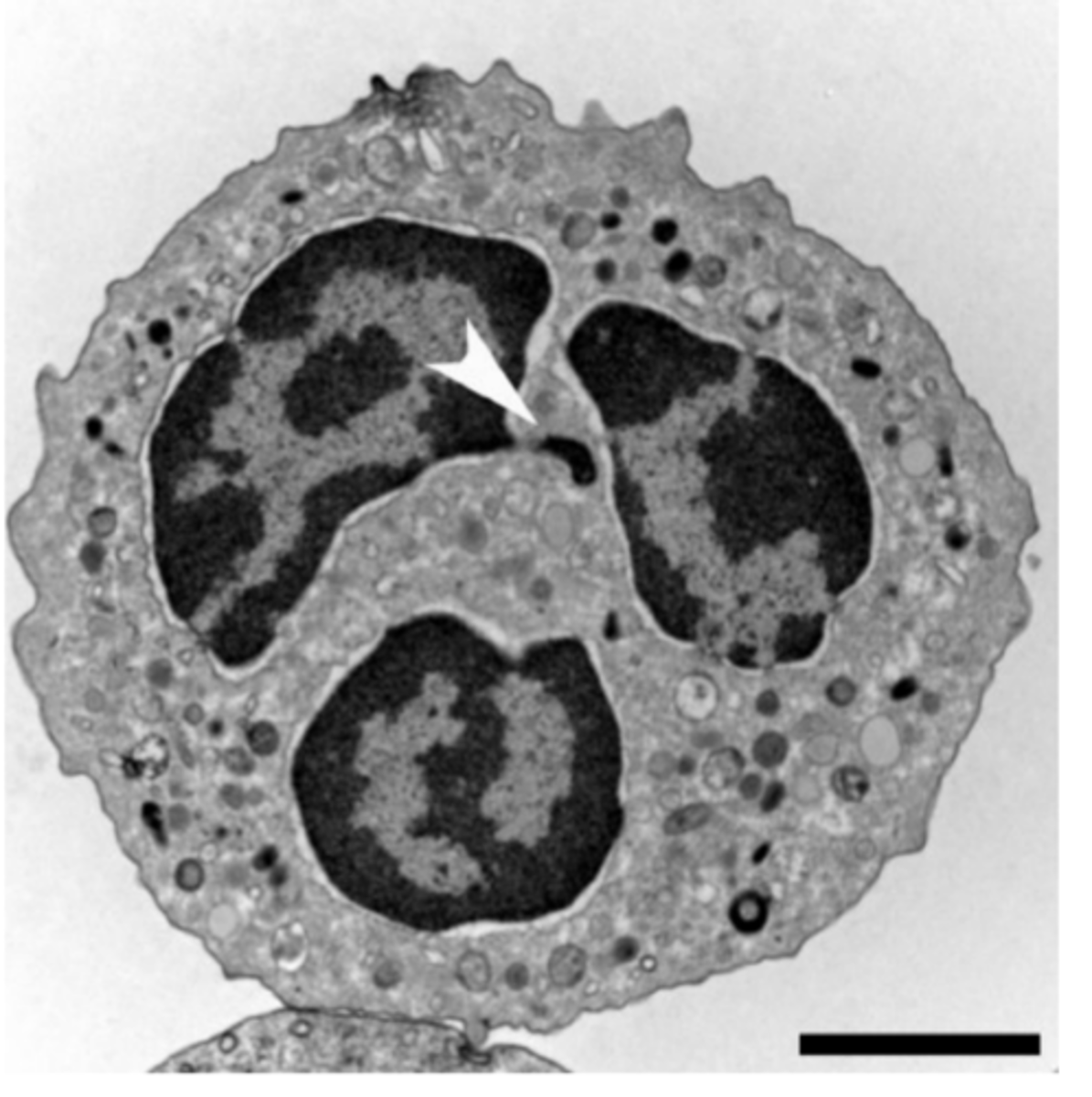 <p>A) ID the specific type of the blood cell</p>