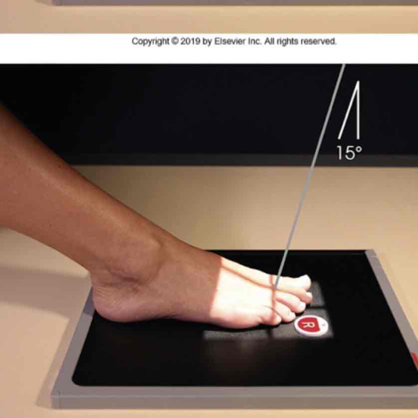 <p>What Projection is this?</p>