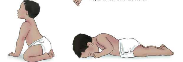 <p>what reflex is this?</p>