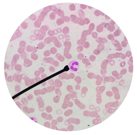 <p>what kind of white blood cells is this?</p>