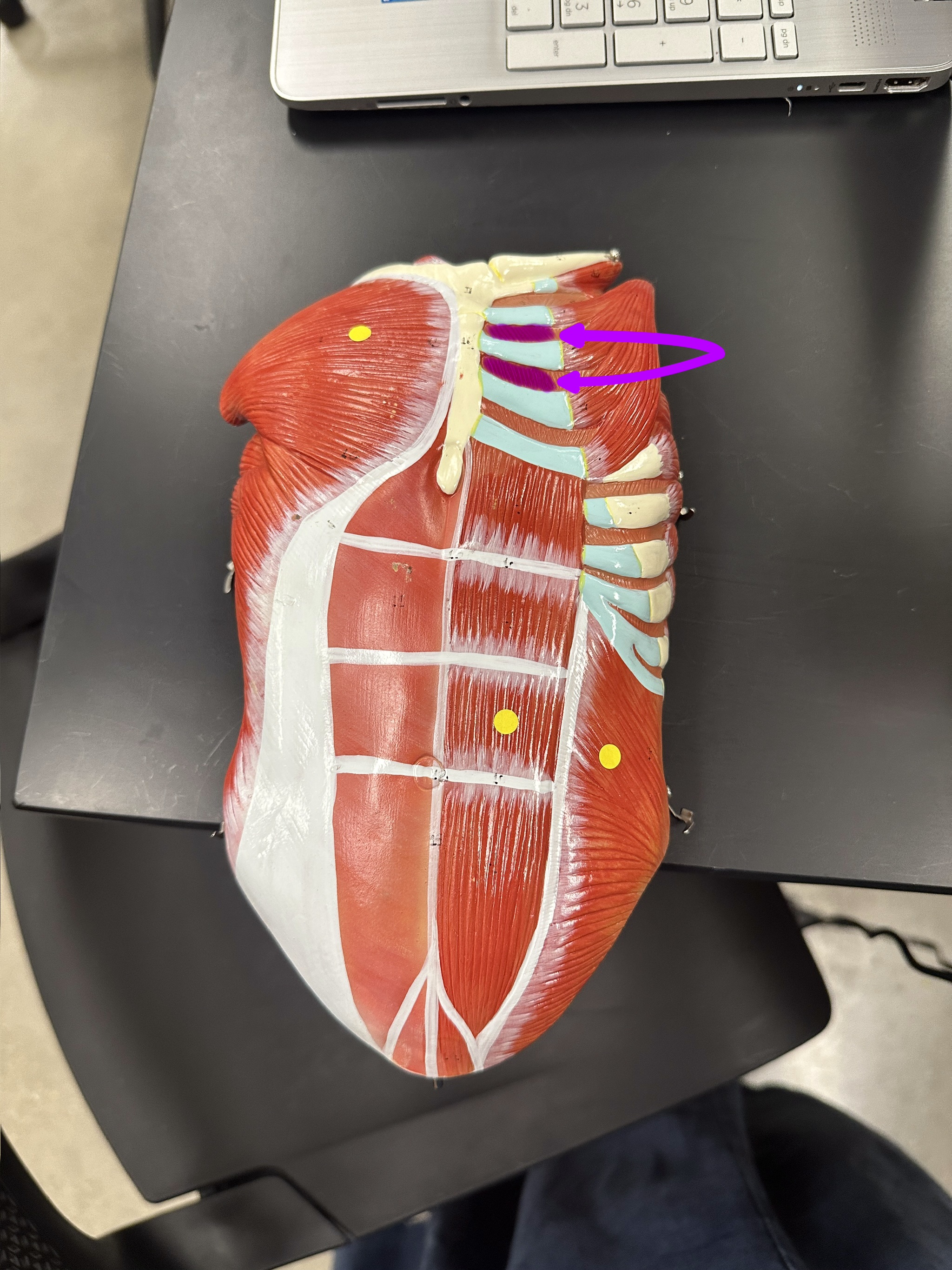 <p>What is the highlighted structure</p>