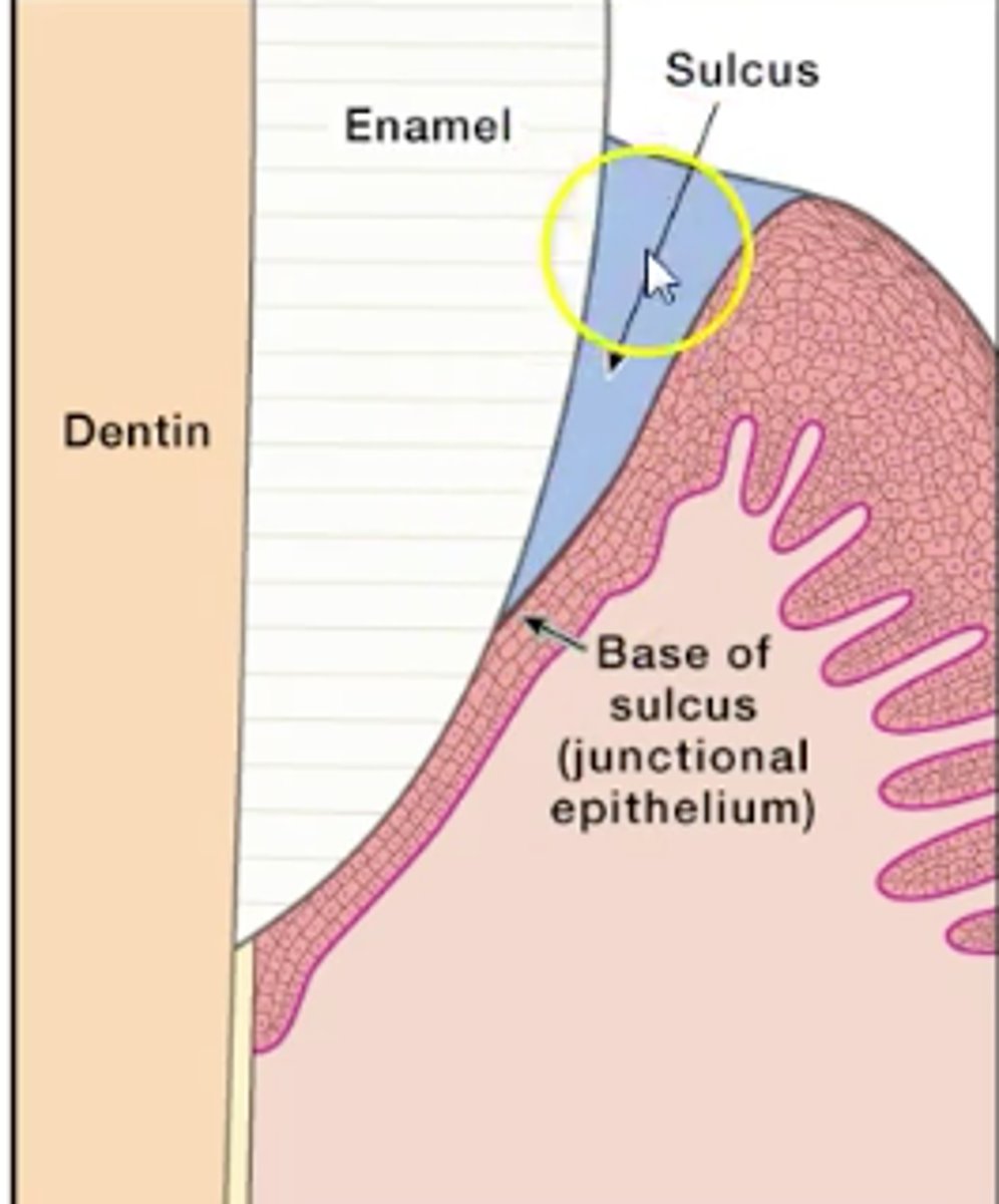 <p>gingival sulcus.</p>