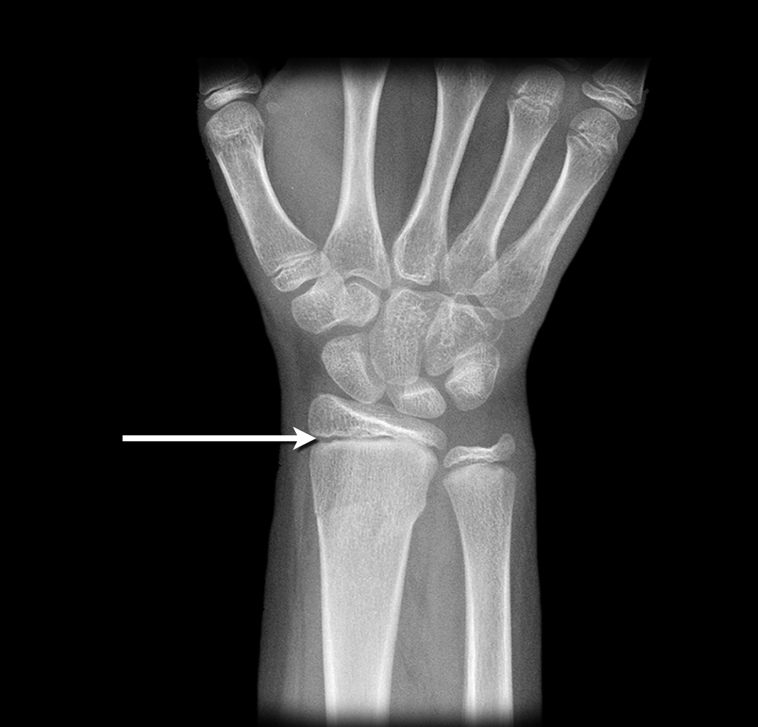 <p>What type of joint and subtype</p>