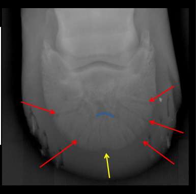 the sole border (2) includes a notch that is called the ...