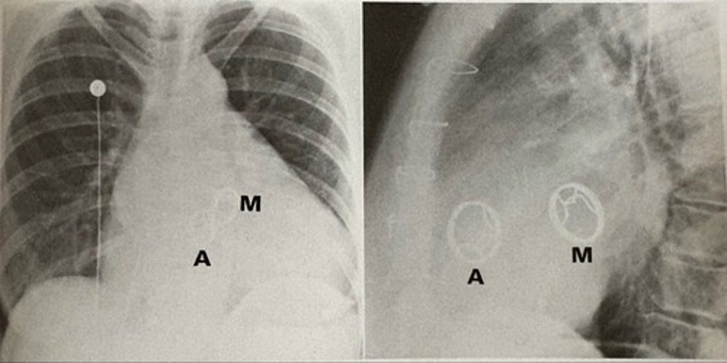 <p>what pathology is present?</p>