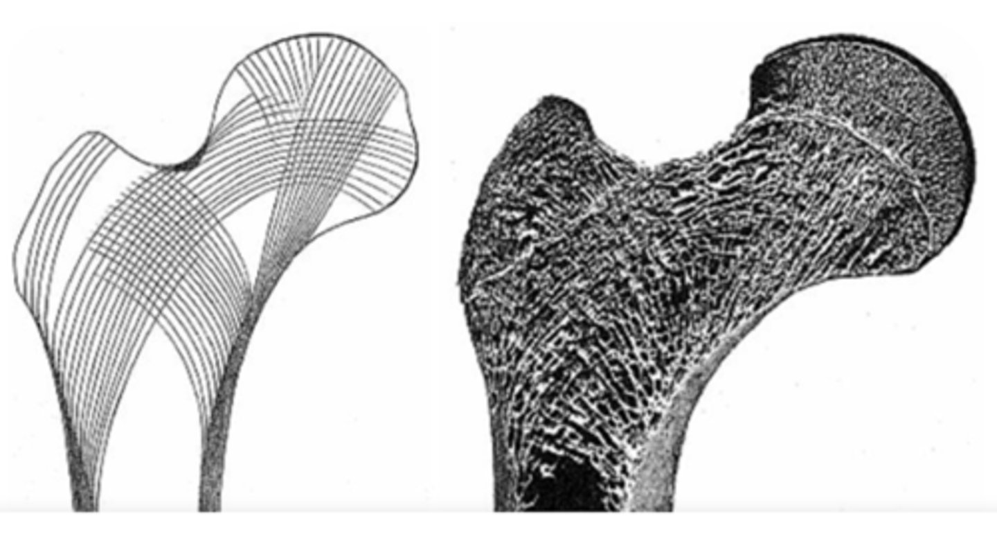 <p>Trabeculae remodeled to align with ....</p>