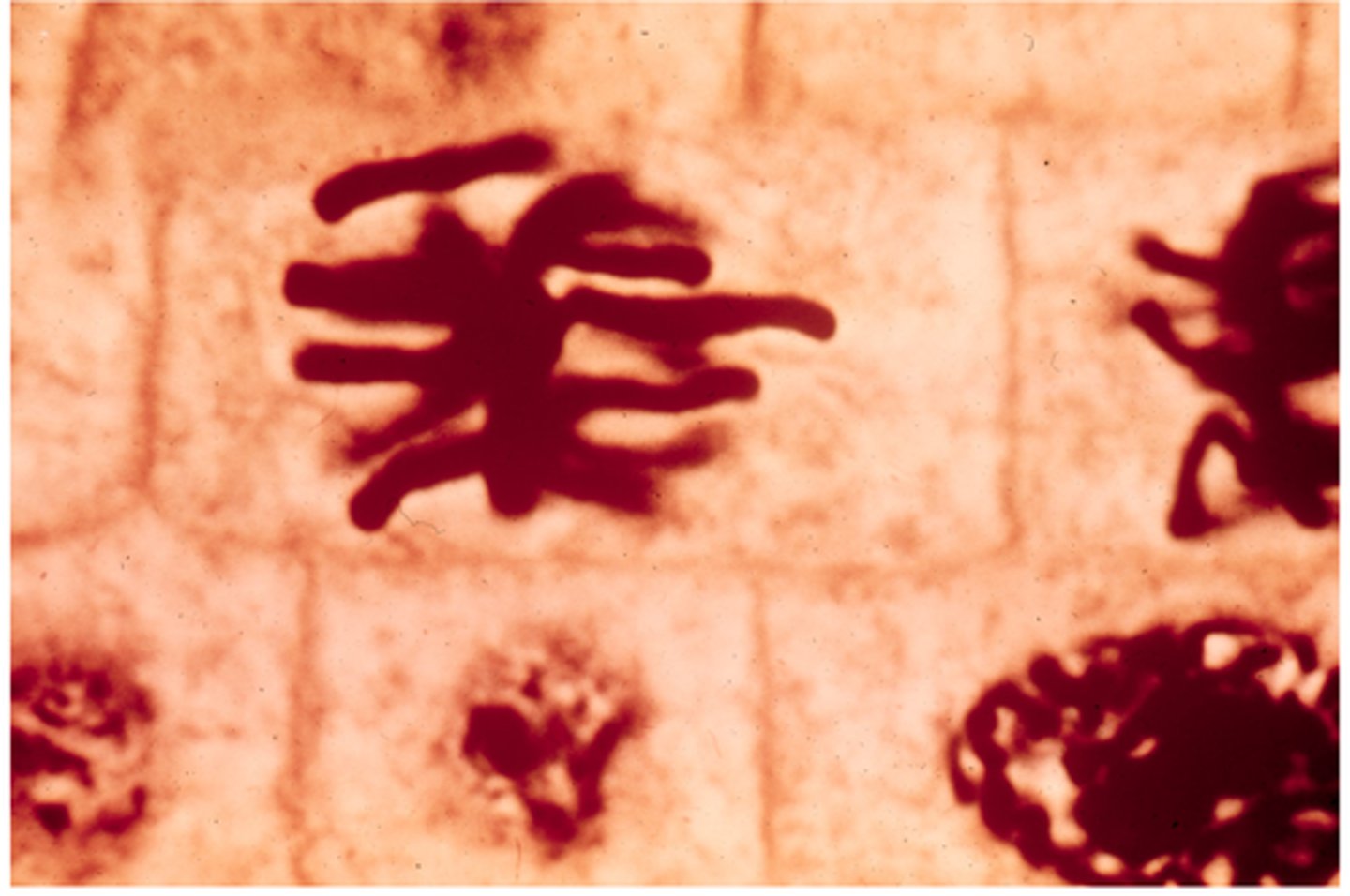 <p>This shows ________ in onion cells.</p>
