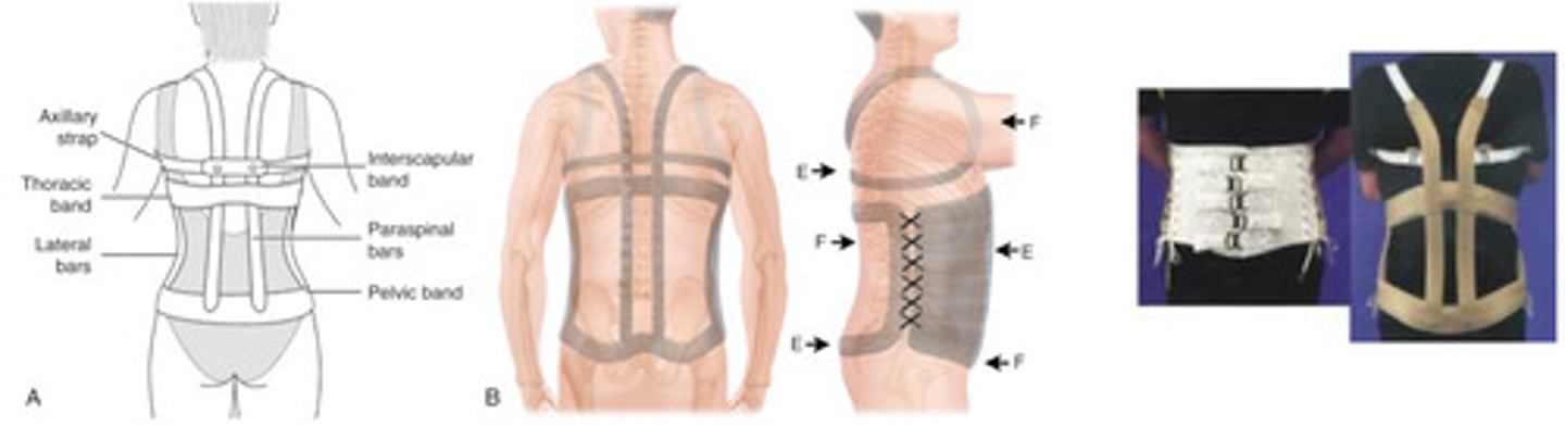 <p>conventional TLSO</p><p>components: thoracic band, pelvic band, paraspinal bars, lateral bars, interscapular band, axilla straps, corset abdominal support</p><p>biomechanical capacity</p><p>limit spinal FL/EXT/LAT bending</p>