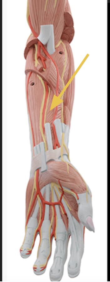 <p>identify + state origin, insertion, action, innervation of marked structure</p>