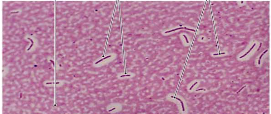 <p>How do you know you are looking at a capsule stain?</p>