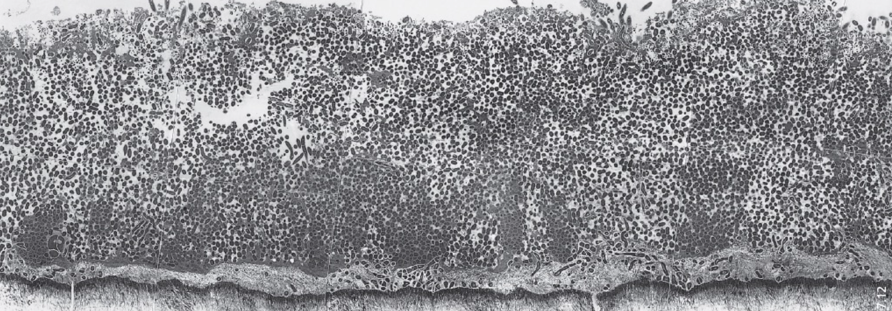 <p>increased diversity </p><p>continued co-adhesion</p><p>growth of micro colonies (1-7 days)</p>