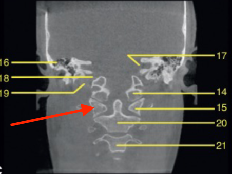 <p>identify the structure </p>