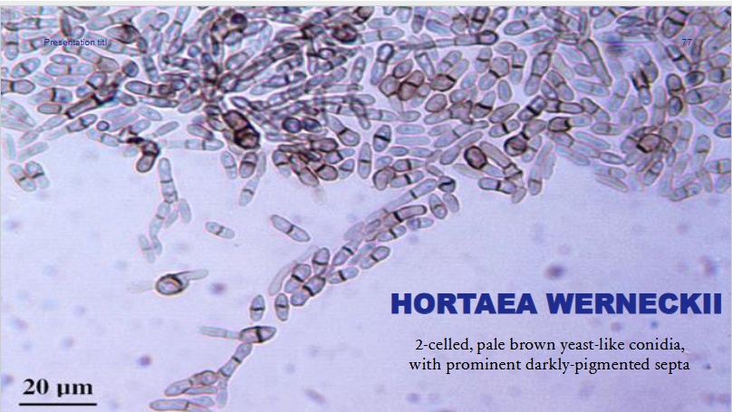 <ul><li><p><span>Formerly known as Wangiella werneckii</span></p></li><li><p><span>Slow grower—matures in 21 days</span></p></li><li><p><span>Moist, shiny, yeast-like at first</span></p></li><li><p><span>Starts brownish then becomes a dull olive black</span></p></li><li><p><span>Reverse is dark</span></p></li><li><p><span>2-celled, brown, yeast-like conidia w darkly pigmented septa</span></p></li></ul><p></p>