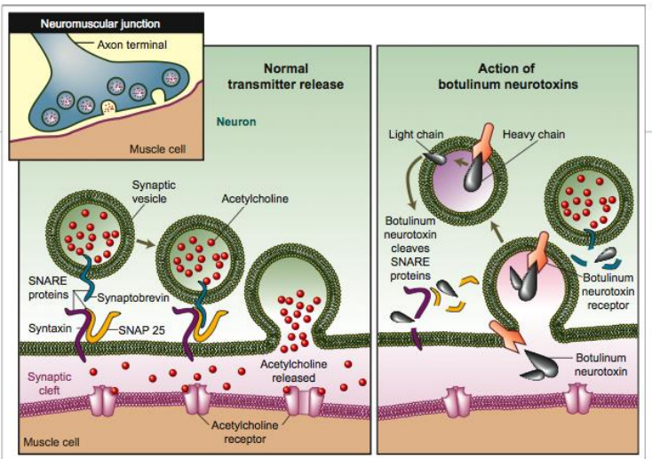 <p>Interferes with release of neurotransmitter (ACh) → paralysis </p>