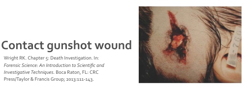 <ul><li><p><span style="background-color: transparent;">Skin can show laceration due to gas blown into the wound that tears it apart, making the skin turn black</span></p></li><li><p><span style="background-color: transparent;">Carbon monoxide reacts with hemoglobin and myoglobin to form carboxyhemoglobin and carboxymyoglobin (bright red)</span></p></li></ul><p></p>