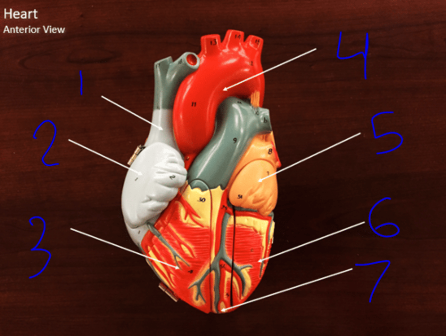 <p>Anterior View - #7</p>