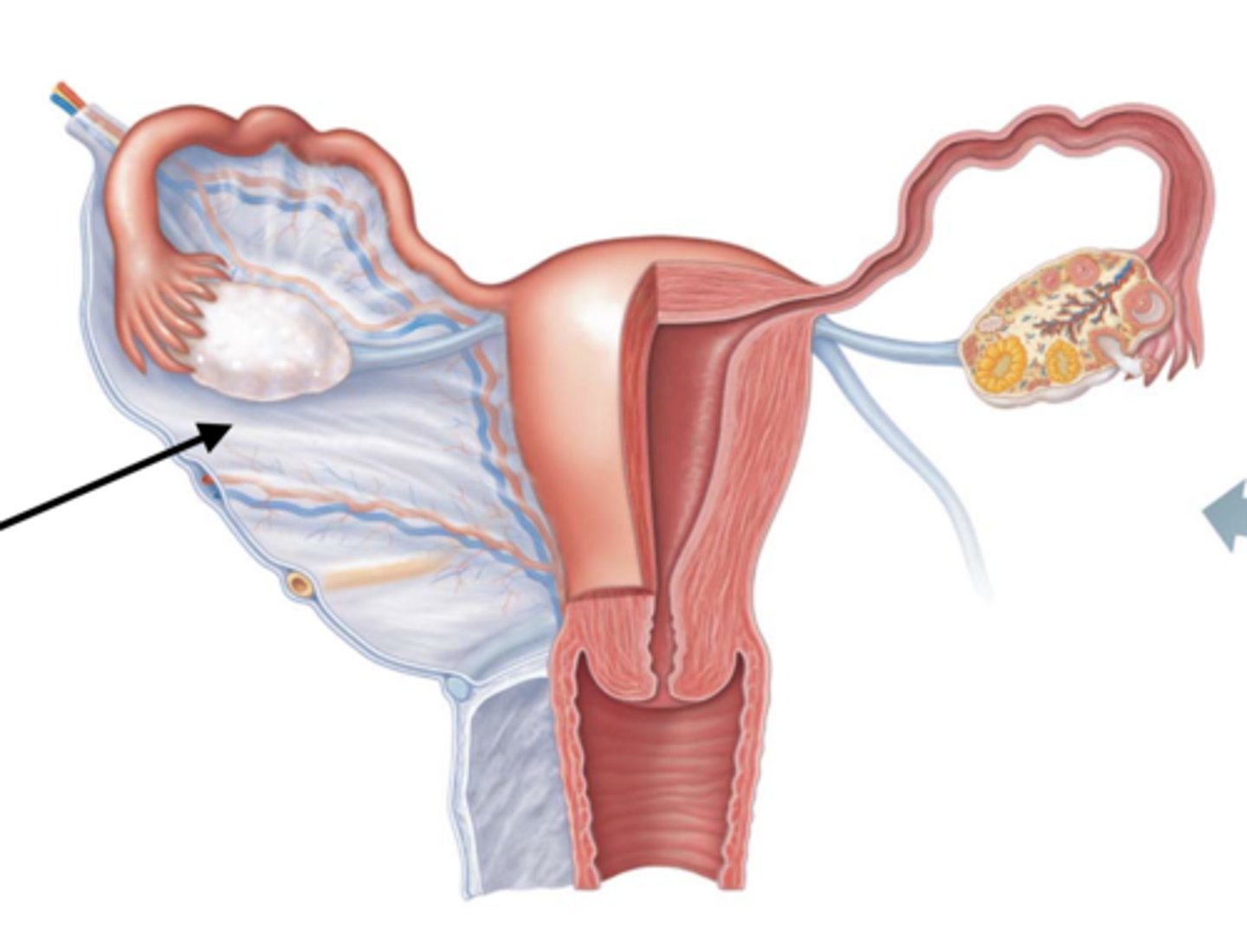 <p>part of the broad ligament</p>