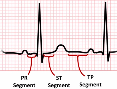 <p>line between 2 waves</p>