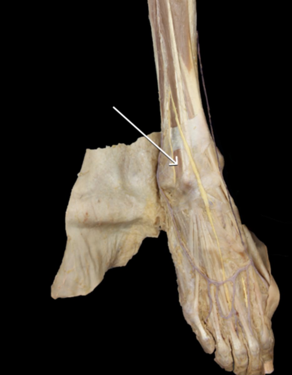 <p>Identify the muscle</p>