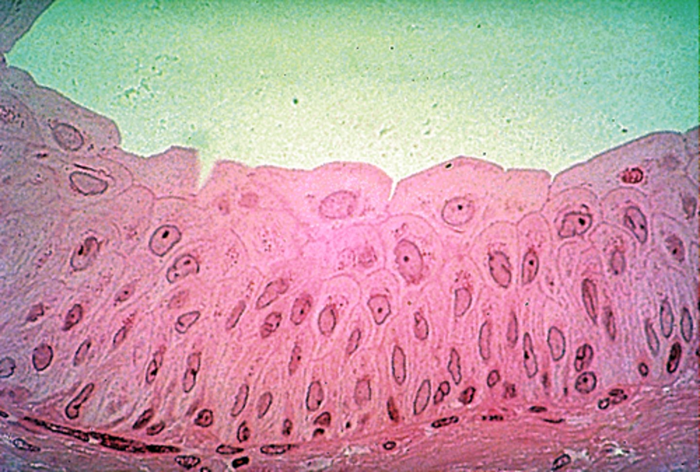 <p>several layers</p>