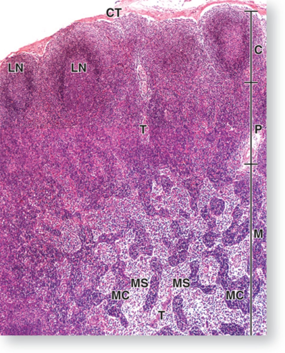 <p>What is in MS?</p><p>Medullary sinuses of medulla contains macrophages and reticular cells</p>