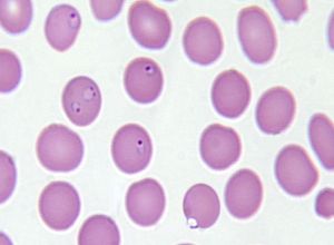 early trophozoite Plasmodium falciparum 
