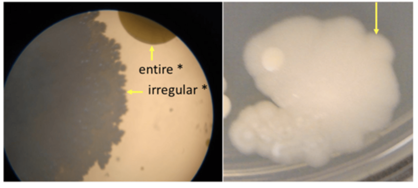 <p>entire, irregular, lobate</p>