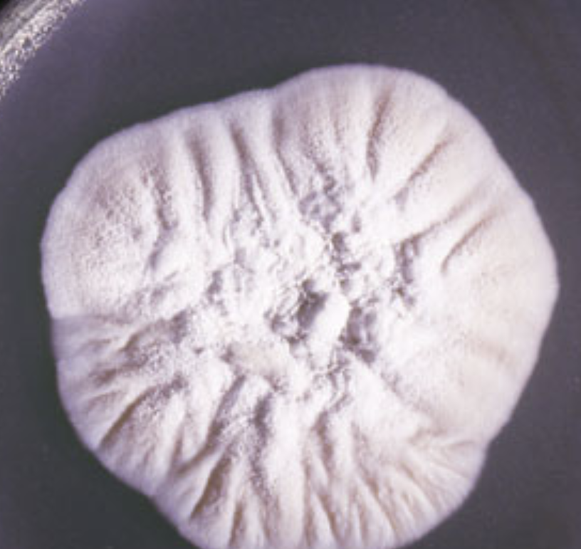<p>What organism is this? Obverse or reverse?</p>