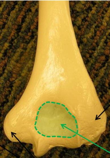 <p>What is the left black arrow pointing to? </p>