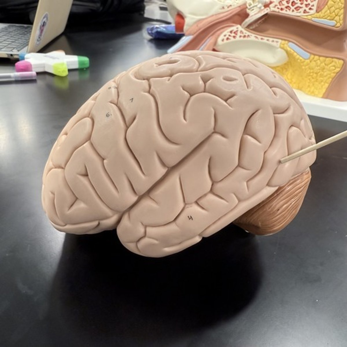 <p>What is this lobe of the cerebrum?</p>