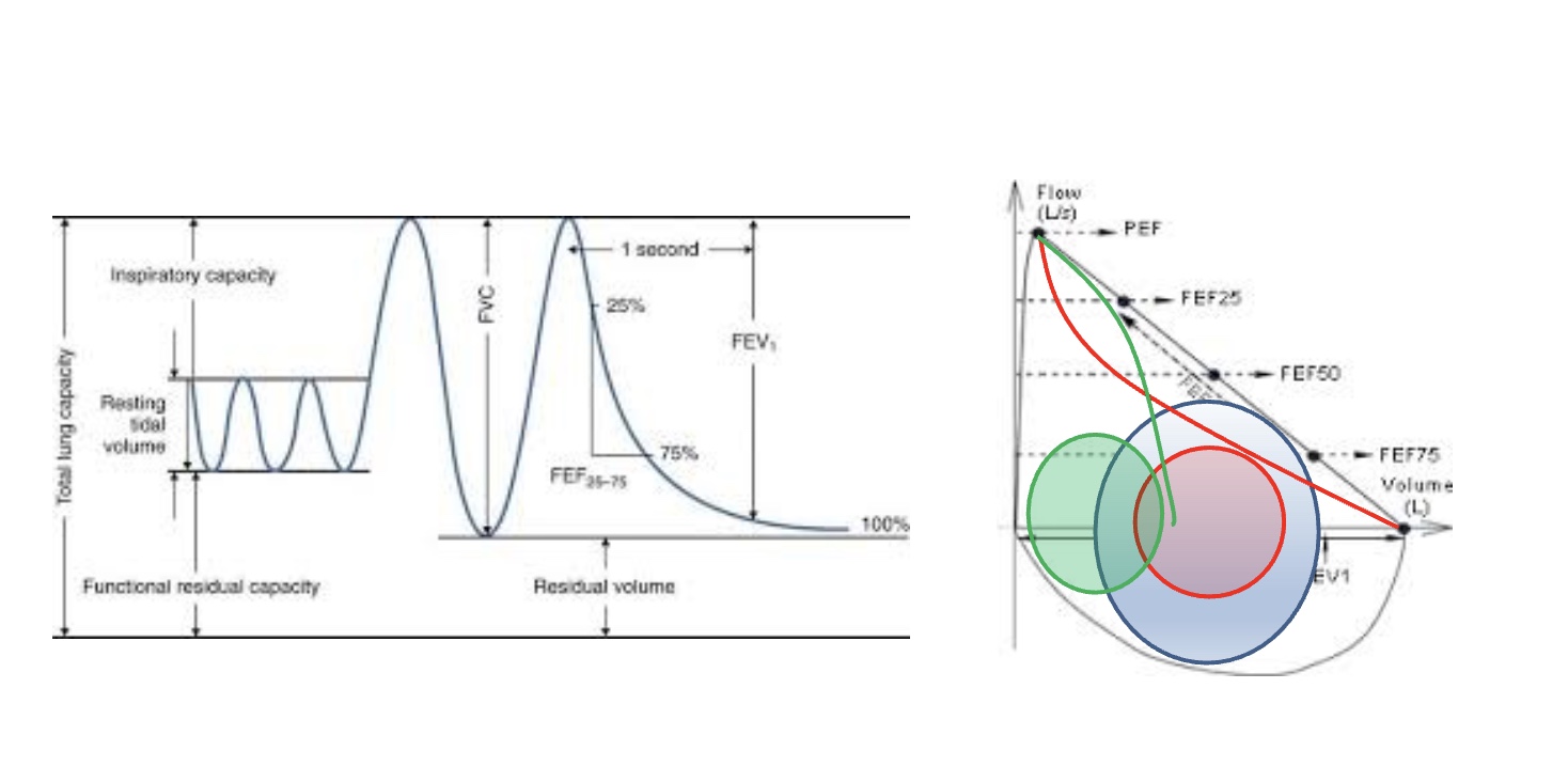 <p>-big breathe in, blast out</p><p>-elasticity=ability to force air out</p><p>-total lung capacity=size of lungs; high TV means don’t have to breathe as fast</p><p>-restrictive: size of lungs smaller (ex: pneumothroax)</p><p>-obstructive: longer ait to come out, thing airway but lung same size; limits TV so breathe faster/short of breath (ex: asthma)</p><p>*either or disrupts TV; ex COPD</p>