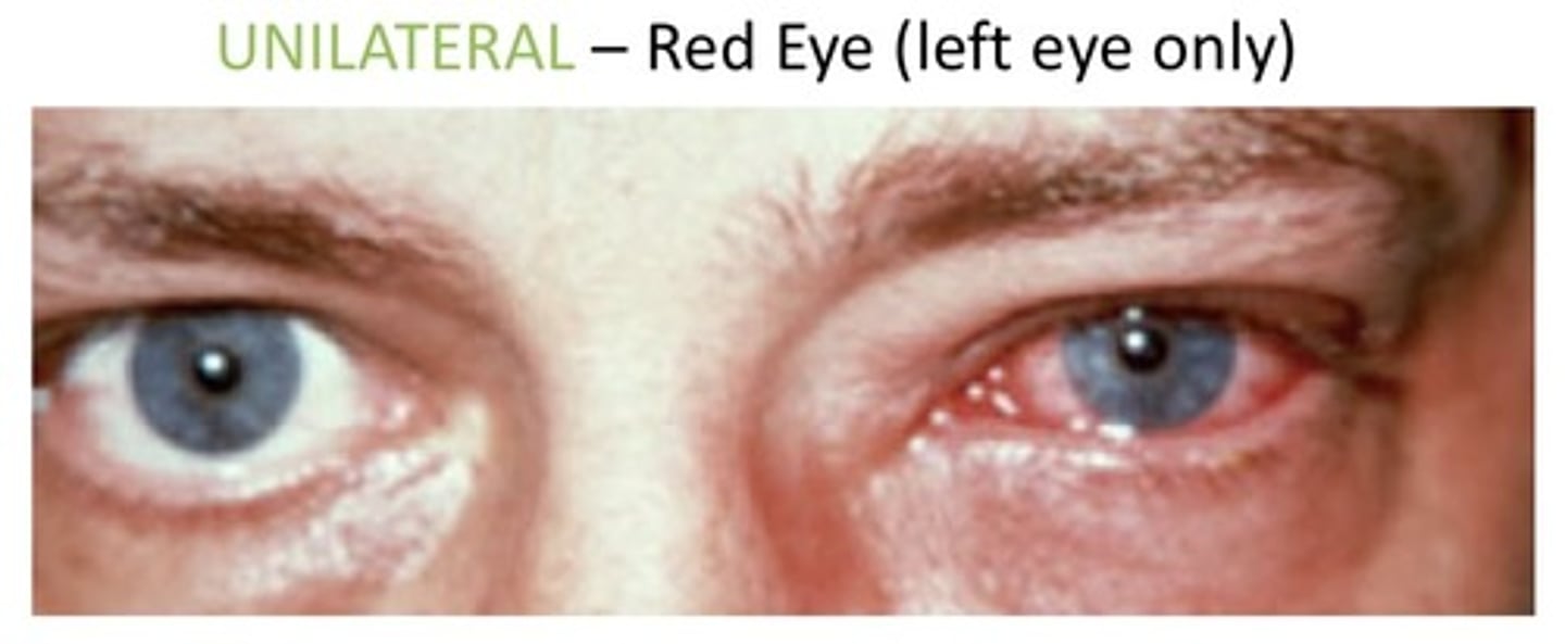 <p>1. One side of an anatomic structure</p><p>2. Used to describe if one eye is red</p><p>3. Used to describe if one sides of the body are weak</p>