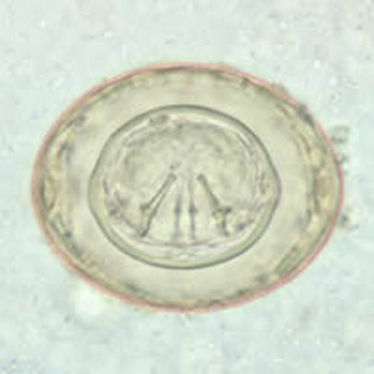 <p>• Eggs have thin inner and</p><p>outer shells</p><p>o About 80 microns</p><p>o Polar filaments between</p><p>shells</p><p>o Embryo with hooklets</p><p>inside inner shell</p>