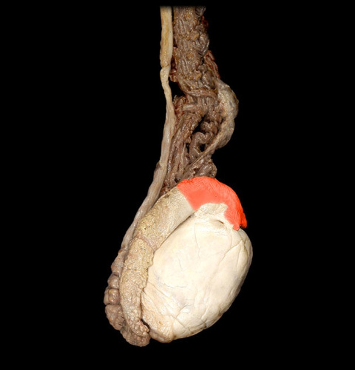 <p>contains efferent ductules and is located on superior aspect of testis</p>