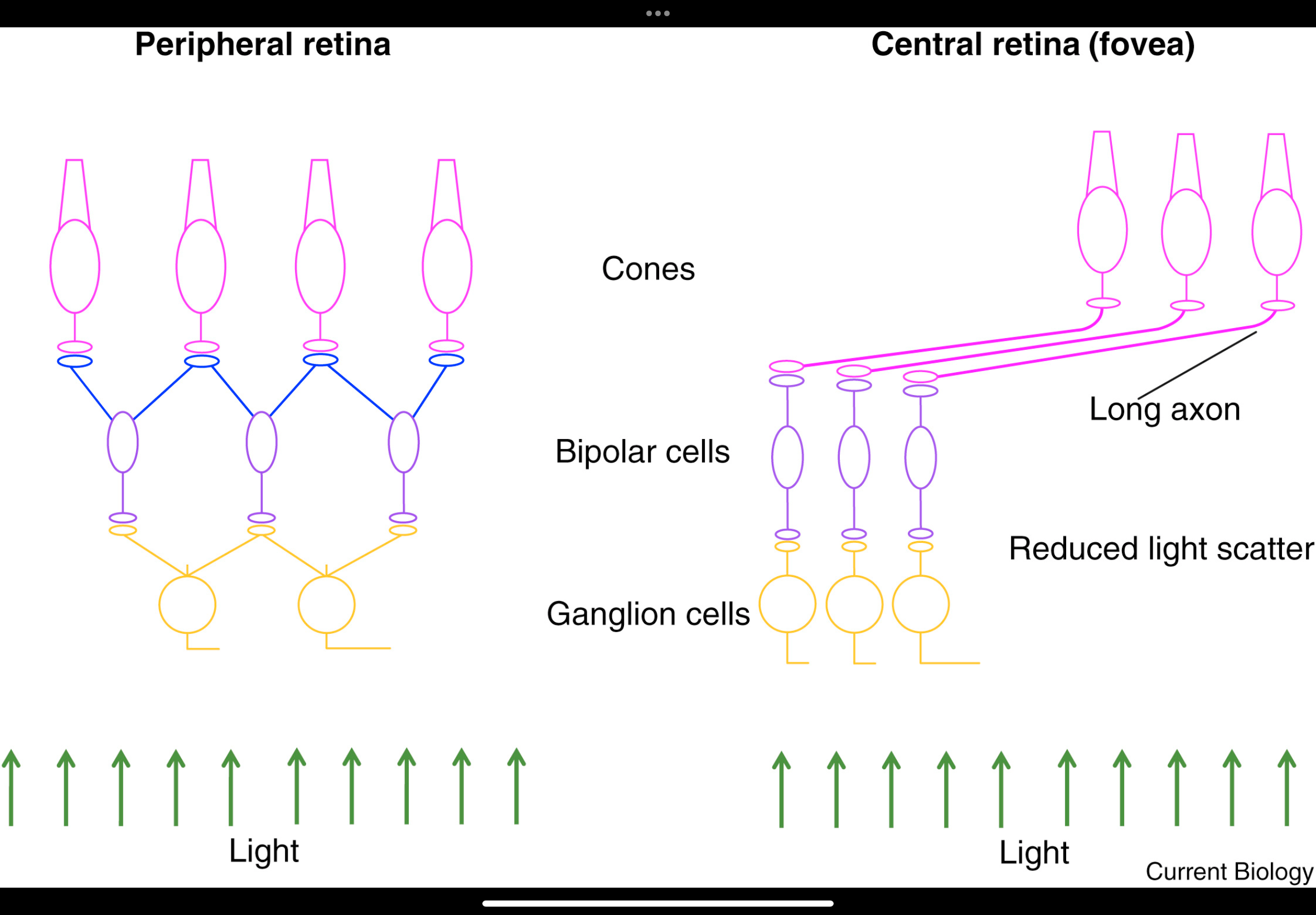 <p>Central (fovea):</p><p class="p1">• Very high cone density</p><p class="p1">• No convergence — 1 cone → 1 bipolar → 1 ganglion cell</p><p class="p1">• Inner layers displaced → minimal optical blur</p><p class="p1">• Highest acuity</p><p class="p1"></p><p class="p1">Central retina (fovea) = low sensitivity</p><ul><li><p>Mostly cones</p></li><li><p>Cones need brighter light</p></li><li><p>Little/no convergence</p></li><li><p>Result:</p><ul><li><p>Excellent detail and colour</p></li><li><p>Poor night vision</p></li></ul></li></ul><p class="p2"></p><p class="p2"></p><p class="p1">Peripheral:</p><p class="p1">• Mixed rods and cones; rods dominant</p><p class="p1">• Large spacing; low sampling density</p><p class="p1">• High convergence → many photoreceptors feed one ganglion cell</p><p class="p1">• Lower resolution, better sensitivity</p><p class="p1"></p><p class="p1">Peripheral retina = high sensitivity</p><ul><li><p>Many rods</p></li><li><p>Rods respond to very small amounts of light</p></li><li><p>Signals from many photoreceptors are added together (convergence)</p></li><li><p>Result:</p><ul><li><p>Great night vision</p></li><li><p>Good at detecting movement</p></li><li><p>Poor detail</p></li></ul></li></ul><p></p><p></p><p></p><ul><li><p><span>Photoreceptor layout</span></p><ul><li><p><span>Cones are larger and more widely spaced.</span></p></li><li><p><span>Many rods sit between cones.</span></p></li></ul></li></ul><p></p><p></p><ul><li><p><span>High convergence</span></p><ul><li><p><span>Signals from many photoreceptors converge onto one ganglion cell.</span></p></li><li><p><span>This pooling averages information.</span></p></li></ul></li></ul><p></p><ul><li><p><span>Effect of distance from fovea</span></p><ul><li><p><span>The further from the fovea, the more convergence.</span></p></li><li><p><span>More convergence → lower resolution.</span></p></li></ul></li></ul><p></p><p></p>