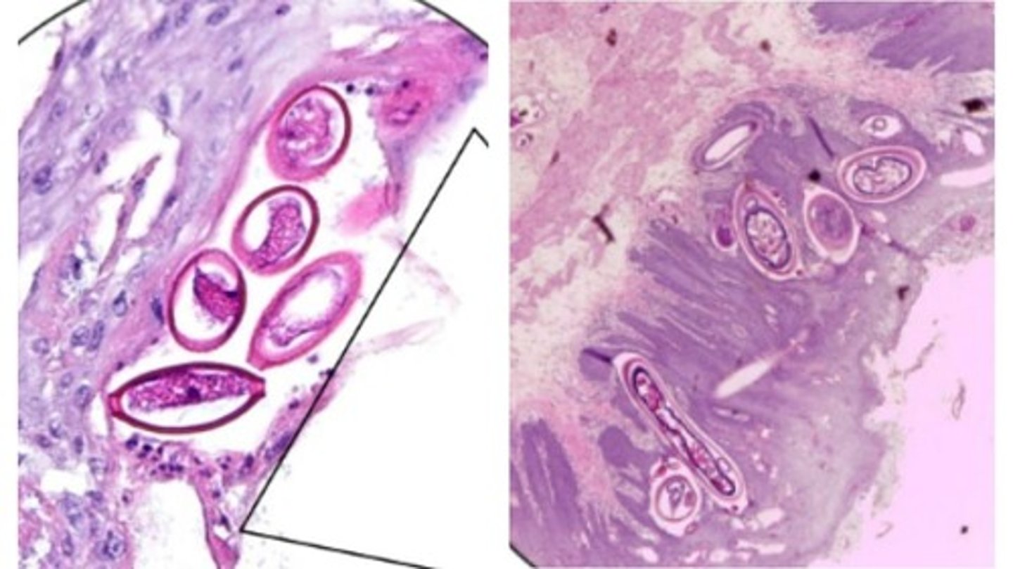 <p>Identify what type of nematode eggs these are.</p><p>-Present in quail </p><p>*Bipolar plugged egg in histo sections can aid in the diagnosis of infection</p>