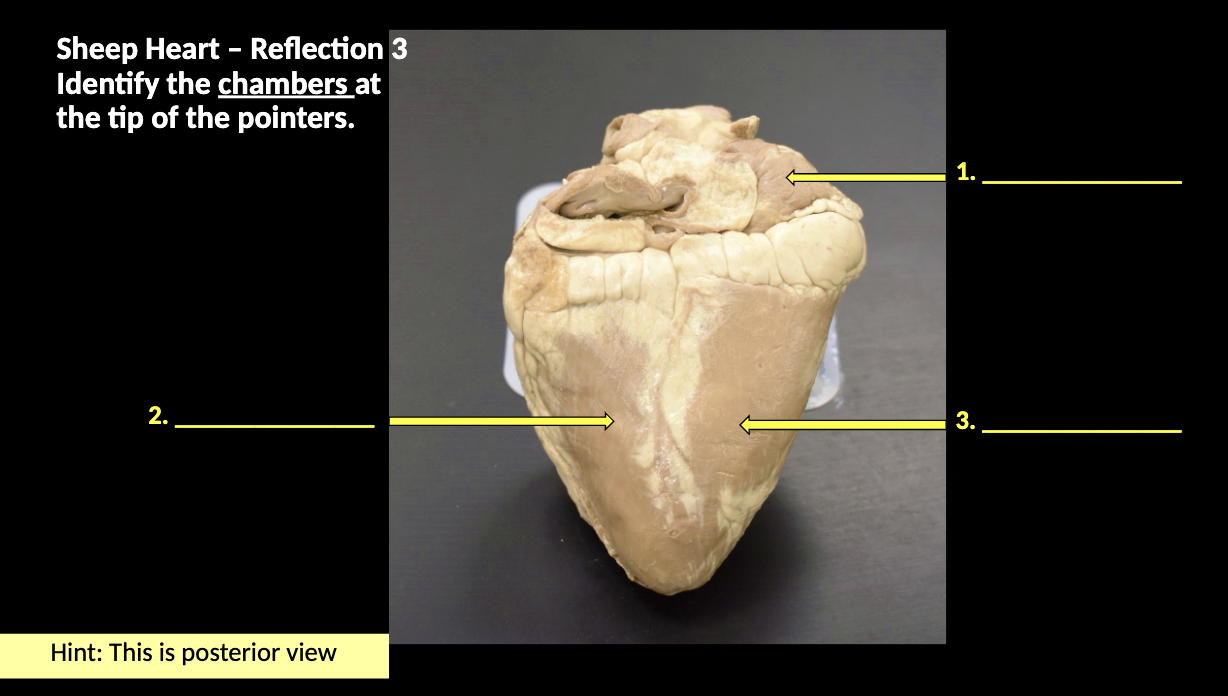 <p>Identify the chambers at the tip of the pointers</p>