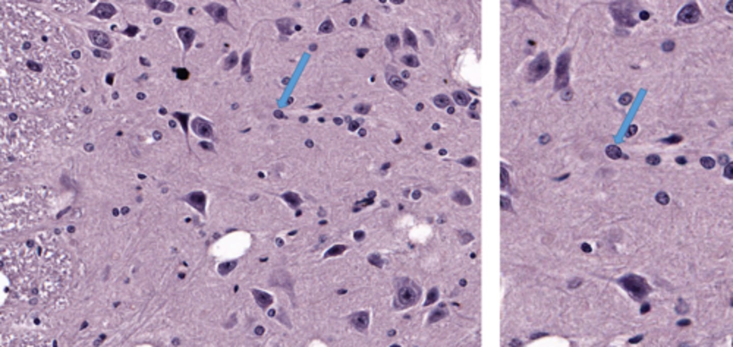 <p>Identify the glial cell</p>