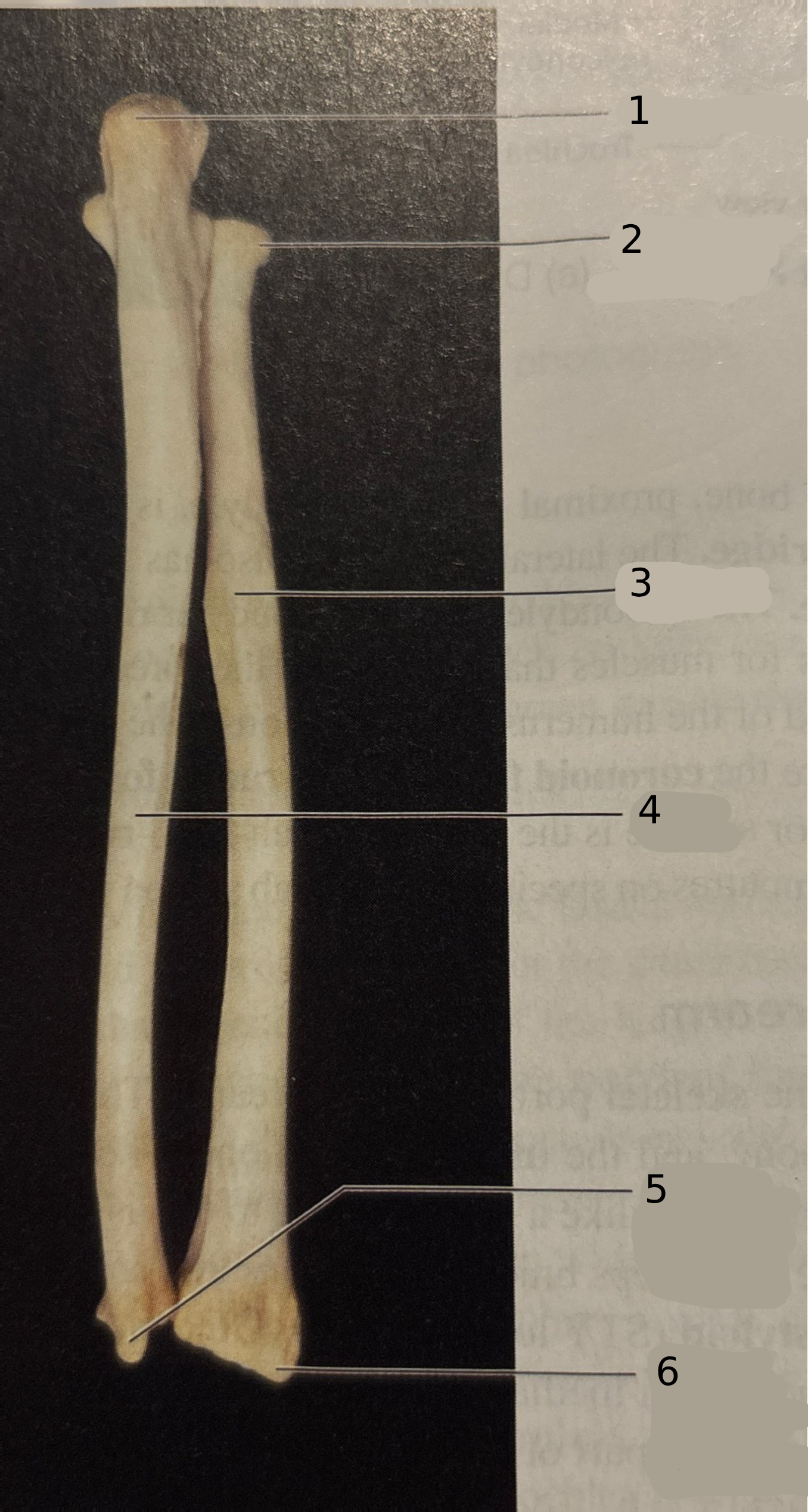 <p>#5</p>