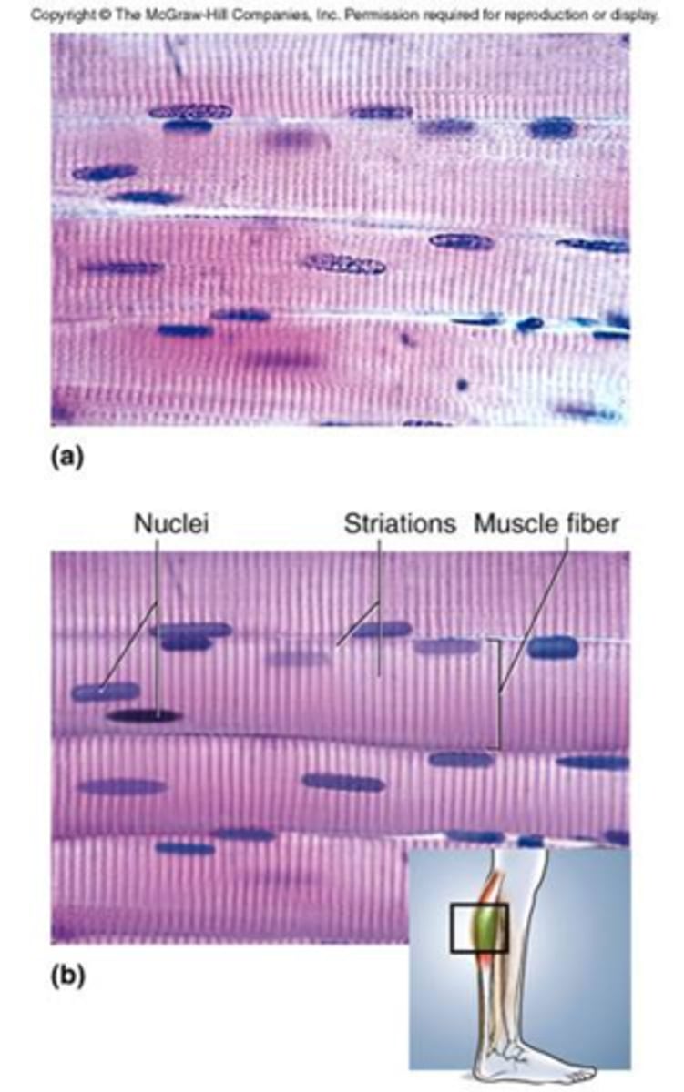<p>This is also called voluntary muscle because it is under voluntary control.</p><p>It is also called striated muscle because it has a striated (striped) appearance due to the presence of actin and myosin filaments.</p><p>It is attached by tendons to bones and that is why it is called skeletal muscle.</p><p>The muscle cells (fibers) are long and cylindrical and have many nuclei.</p><p>Examples are gluteus maximus, biceps brachii, deltoid, etc. </p>