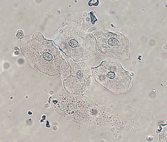 <p>Reported on LPF or HPF</p>