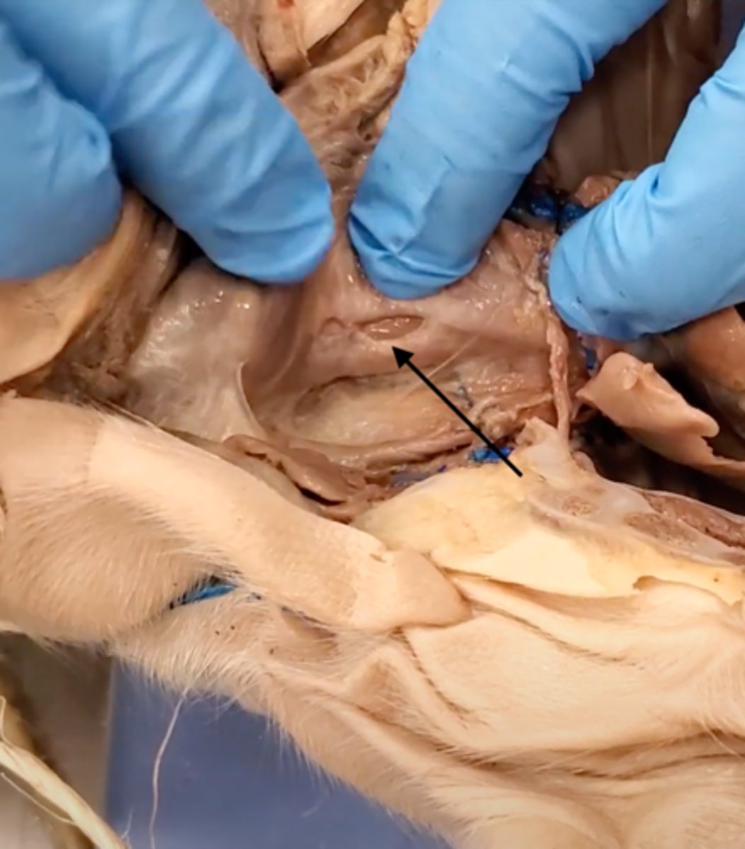 <p>A muscular tube that connects the mouth to the stomach.</p>
