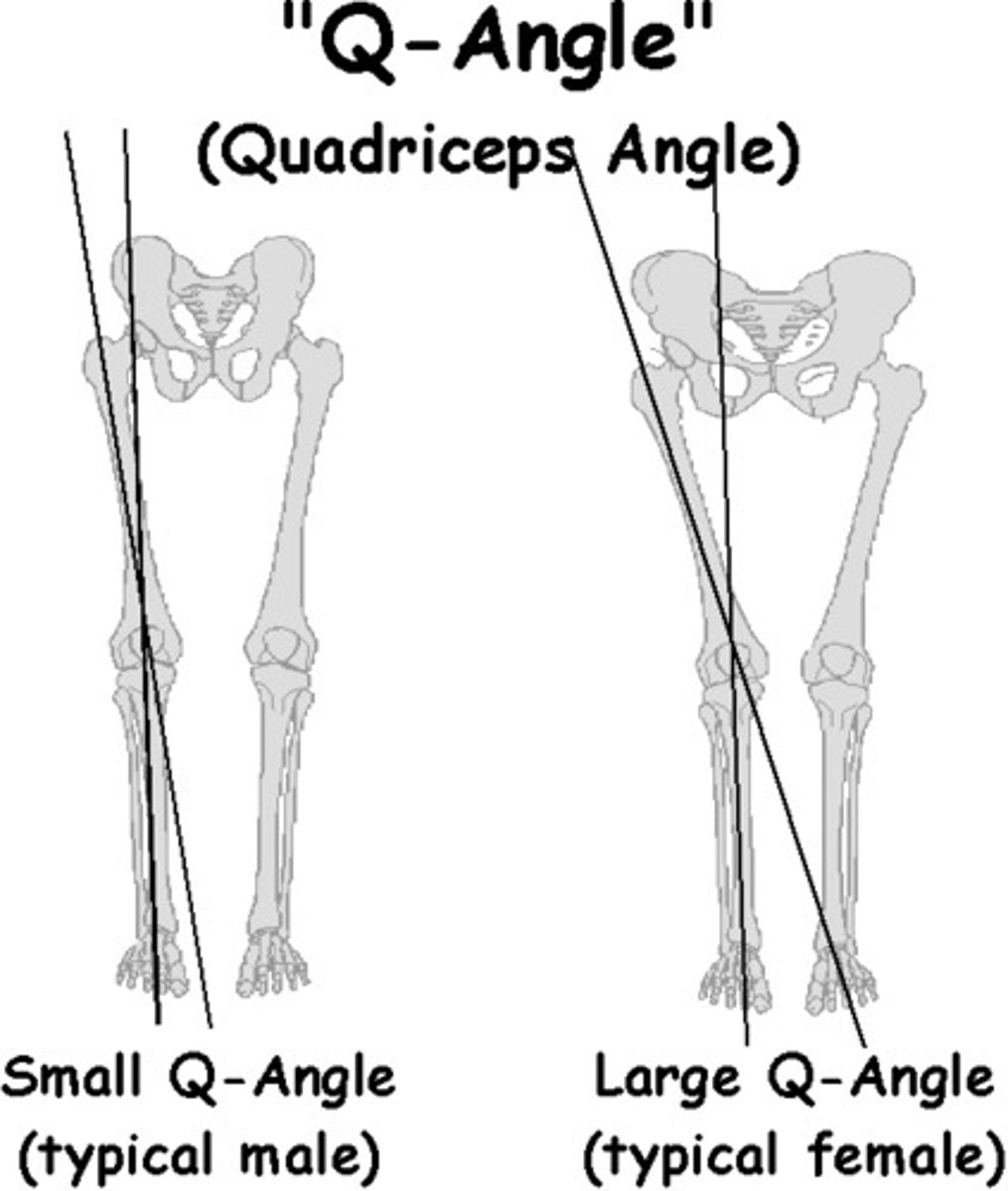 <p>patellofemoral syndrome →</p><p>+ apprehensive and + Ober test</p><p>common in women bc of Q angle</p>