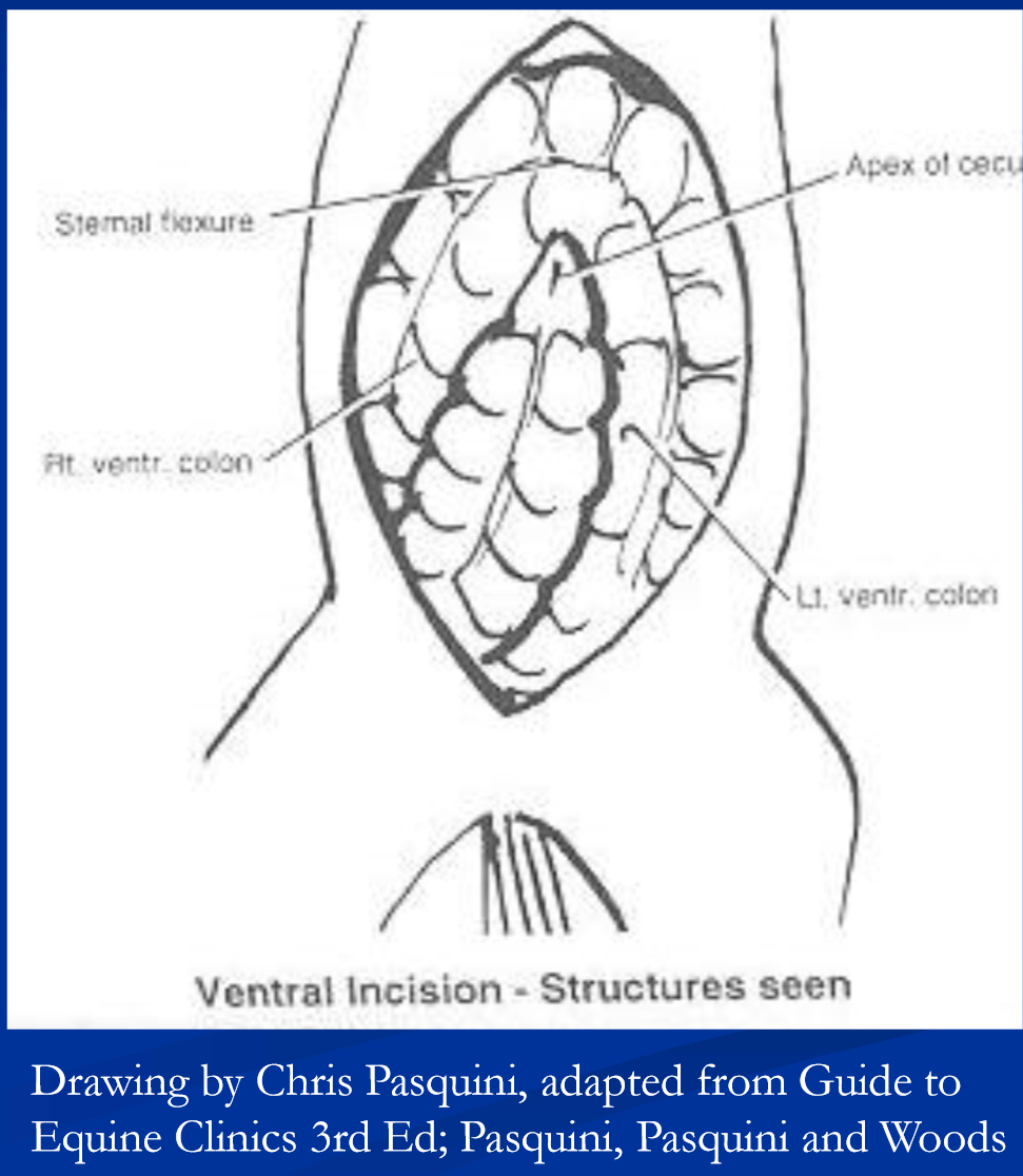 <p>Exploratory laparotomy </p>
