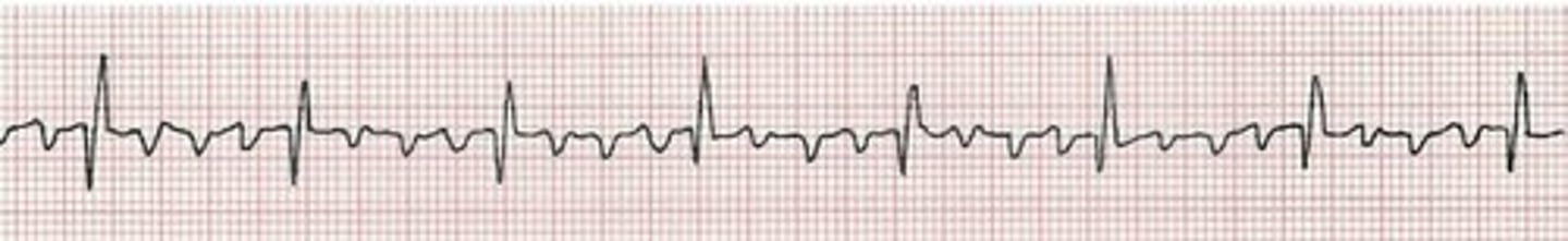 <p>receives blood returning to the heart from the pulmonary veins</p>